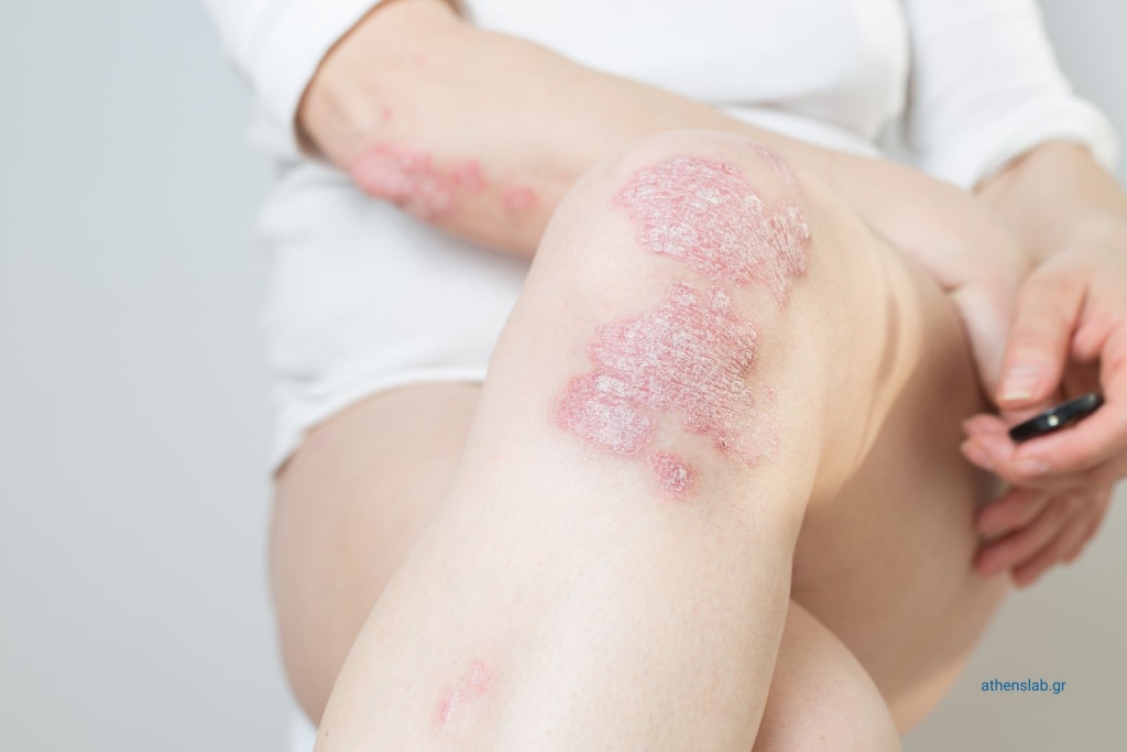 Dermatology