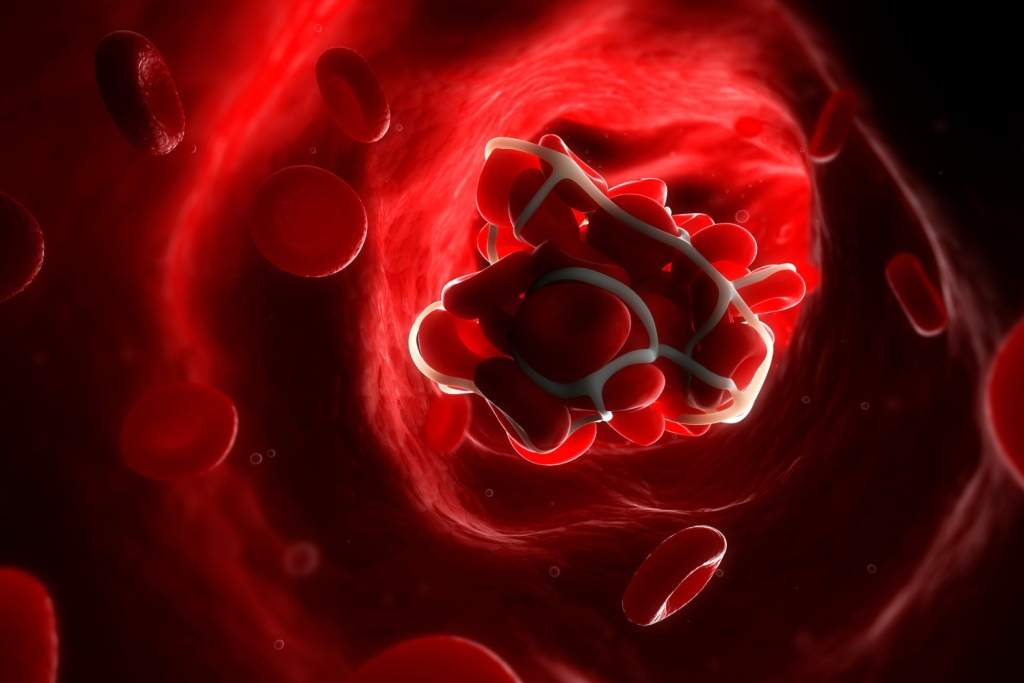 Autoimmune Diseases