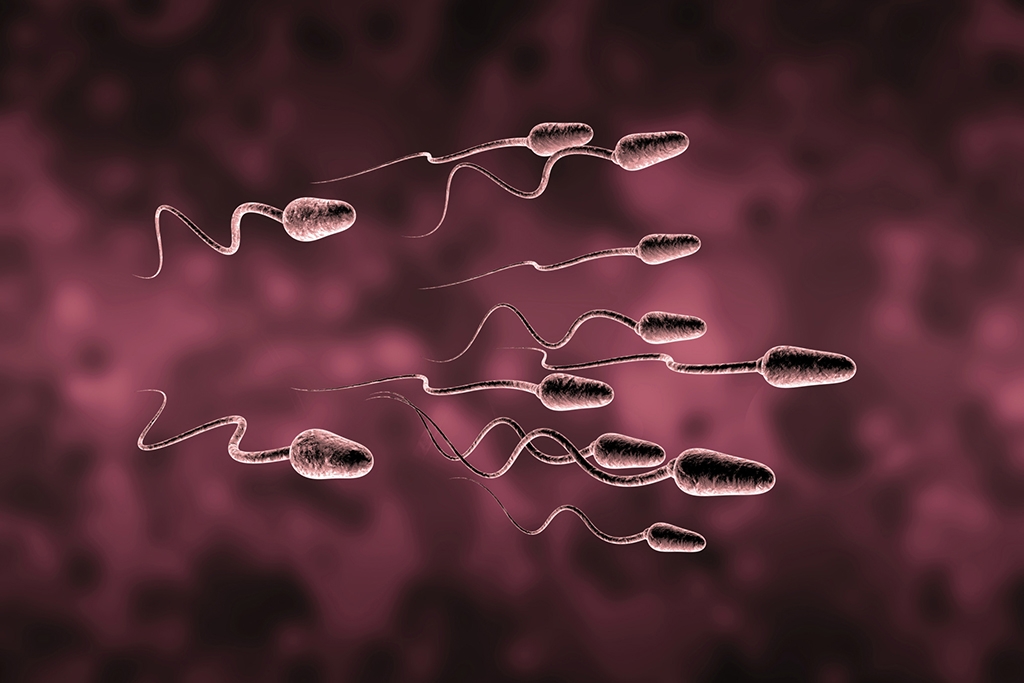 Υπογονιμότητα - SpermaScan®