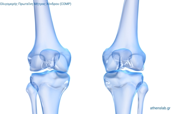 Orthopedics